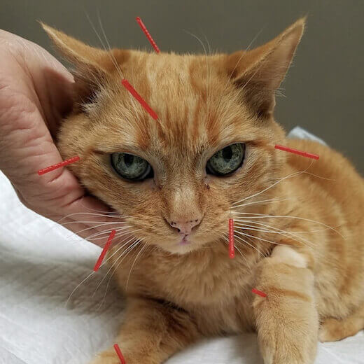 Acupuncture