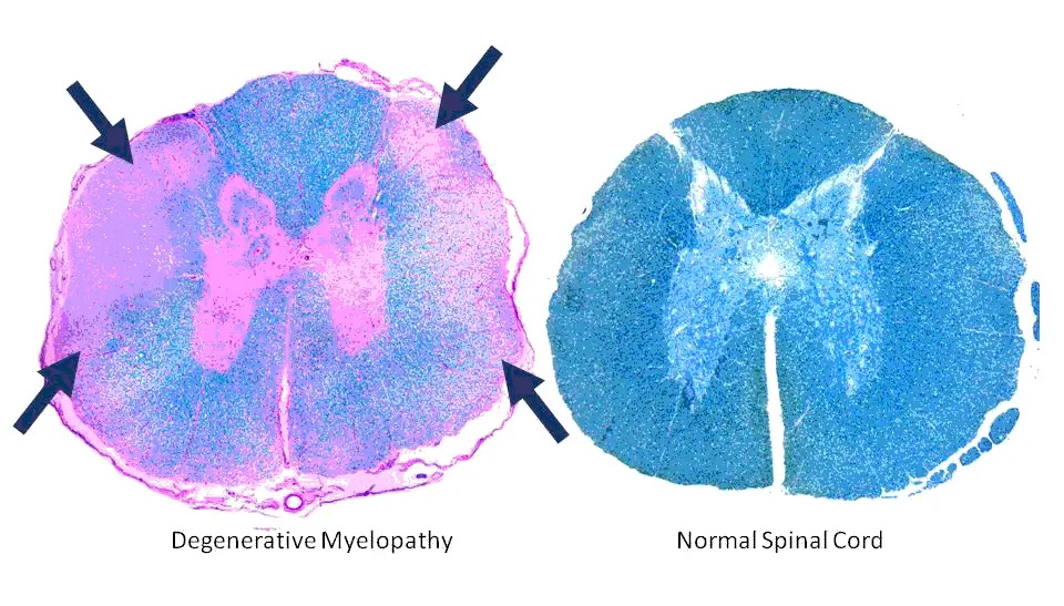 Spinal cord comparison of degenerative myelopathy